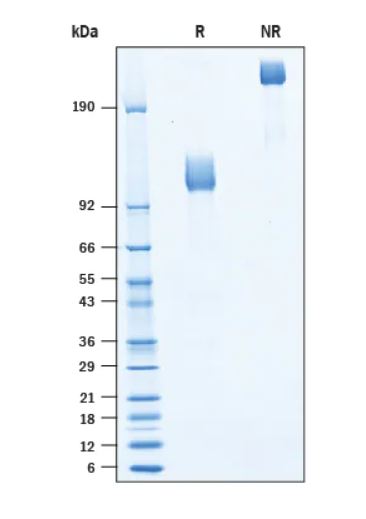 2 μg/lane Protein  was resolved with SDS-PAGE under reducing (R) and non-reducing (NR) conditions and visualized by Coomassie® Blue staining.